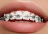 Best Orthodontists in Lahore